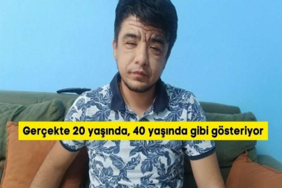 Gerçekte 20 yaşında, 40 yaşında gibi gösteriyor