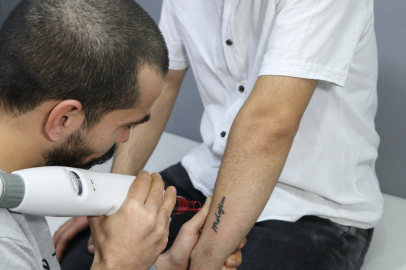 Adana'da 14 Şubat Sevgililer Günü telaşı, ayrılan çiftler dövme sildirme telaşına girdi