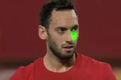 Hakan Çalhanoğlu'nu lazer bile durduramadı