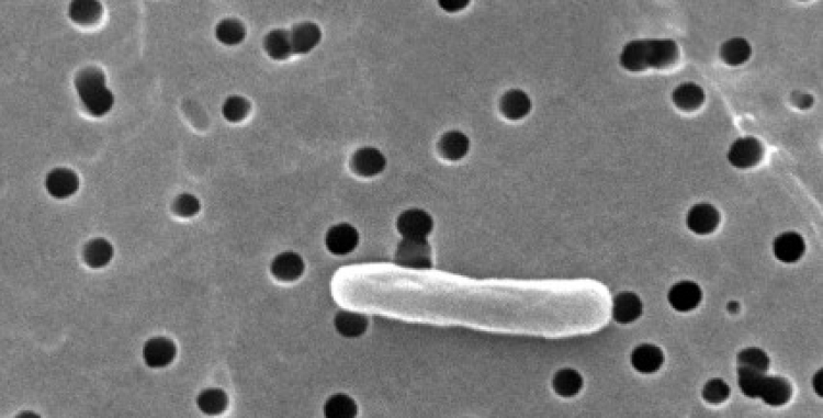 e coli bakterisi